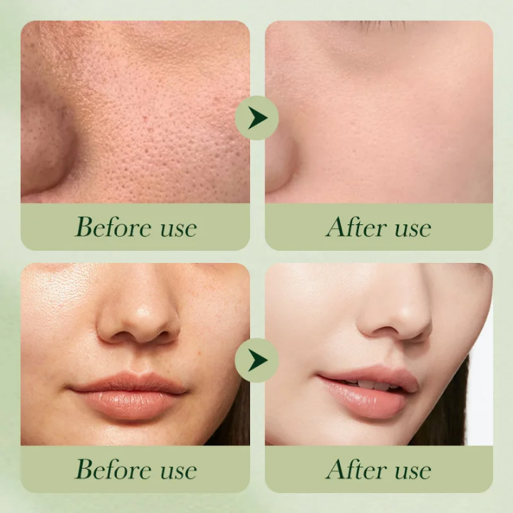 Produits de beauté pour le visage a l'avocat, ensemble de soin personnel pour la peau. - Cash Boutique